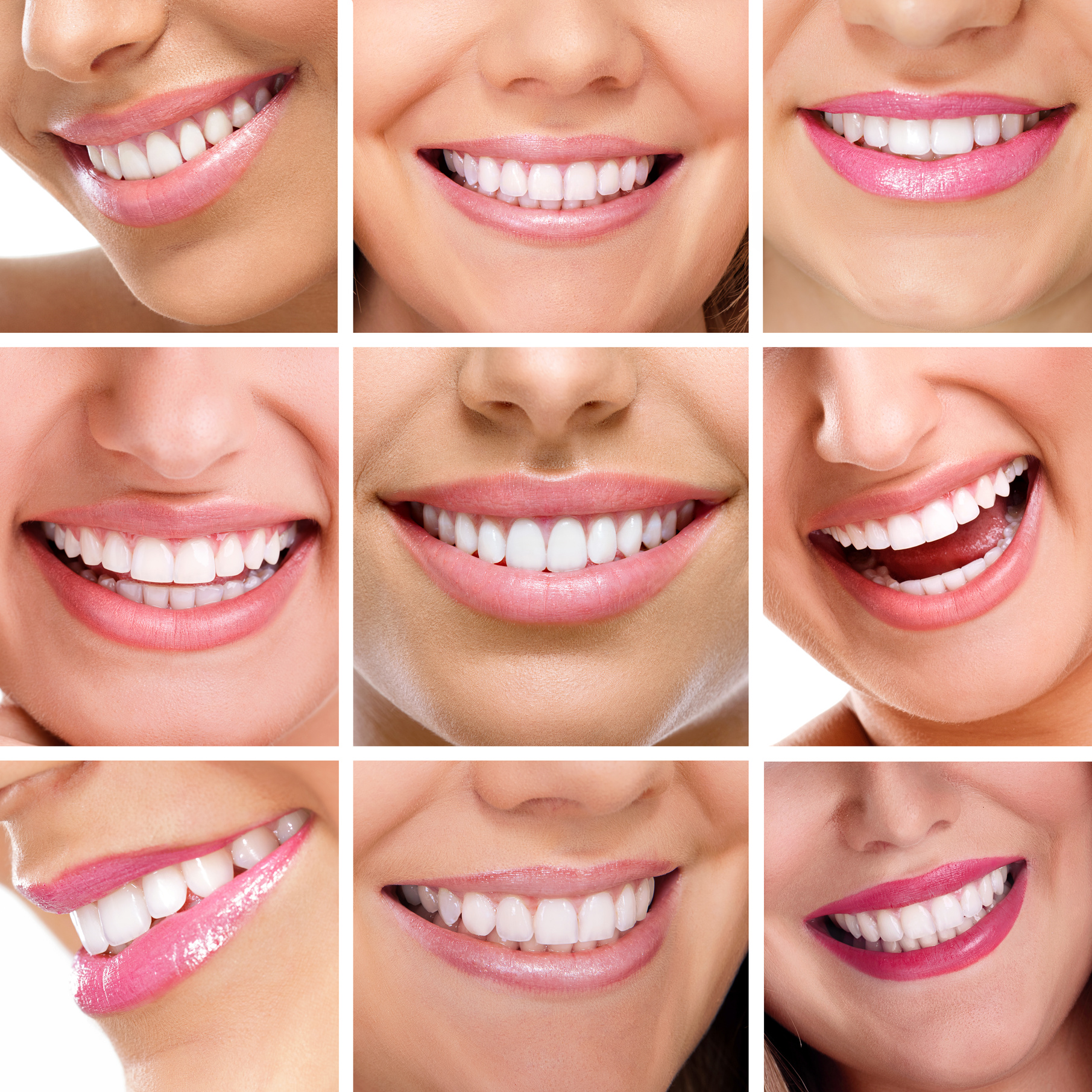 teeth collage of people smiles